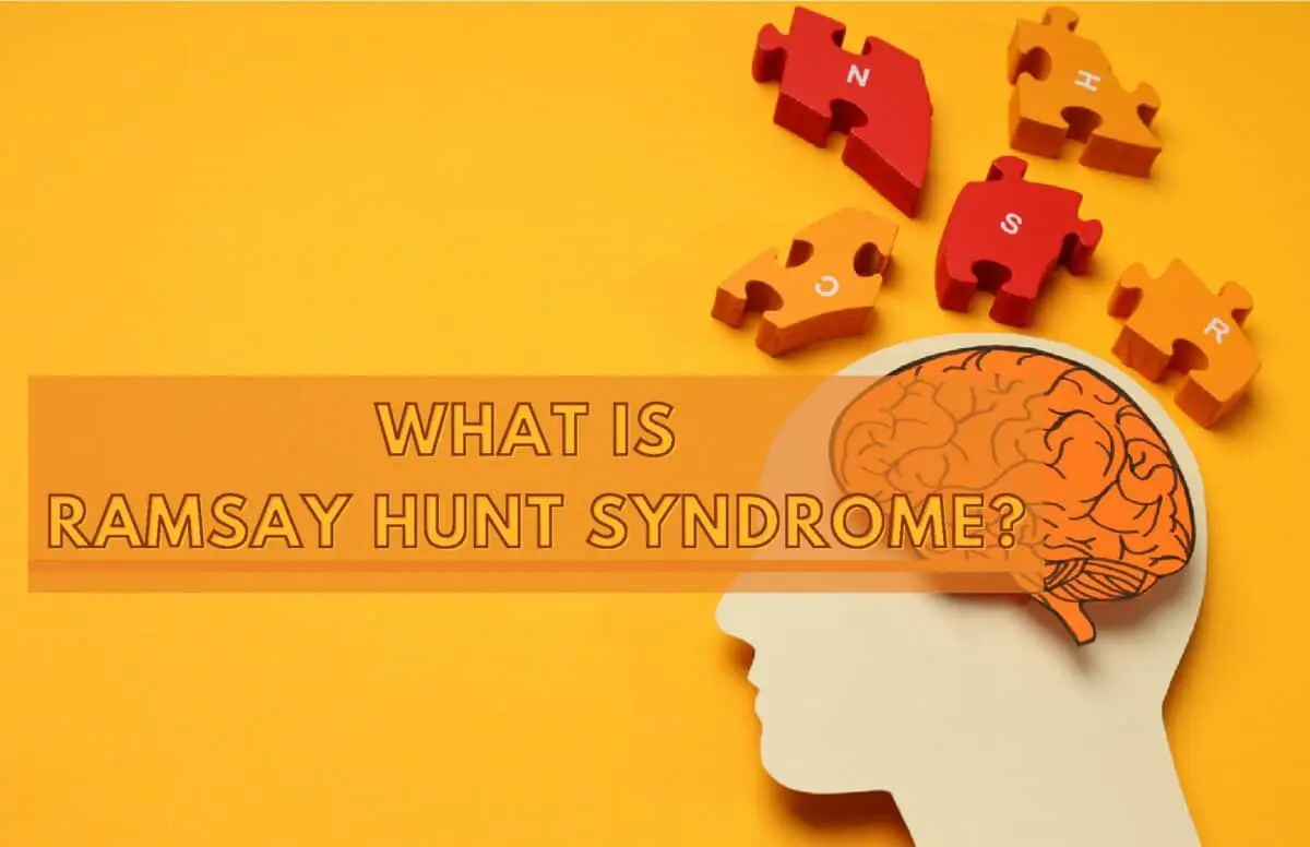 ramsey hunt syndrome